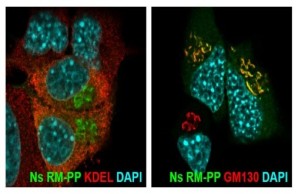  Staining of RM-PP mutant neuroserpin in AtT-20 cells reveals colocalization with the Golgi-marker GM130, but not with the ER-marker KDEL.